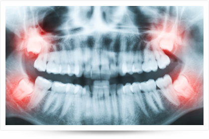 chirurgies dentaire pratiquées